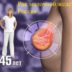 Молочная железа народные методы лечения thumbnail